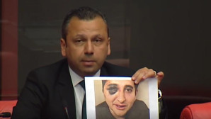 CHP’li Erbay: Darp edilen avukat meslektaşımızın serbest kalması olayı kapatamaz .