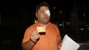 Fethiye’de gazeteciye saldırı