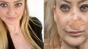 Turistik kentte  dişlerini yaptıran turistin burnu çöktü!