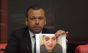 CHP’li Erbay: Darp edilen avukat meslektaşımızın serbest kalması olayı kapatamaz .